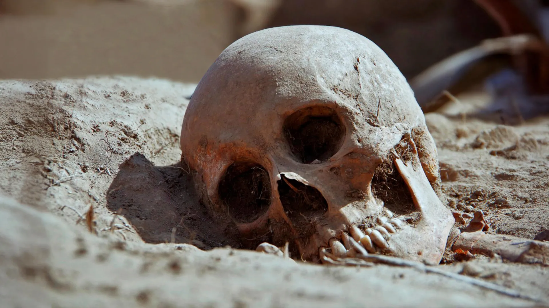 3,500-year-old skeletons challenge a key syphilis assumption