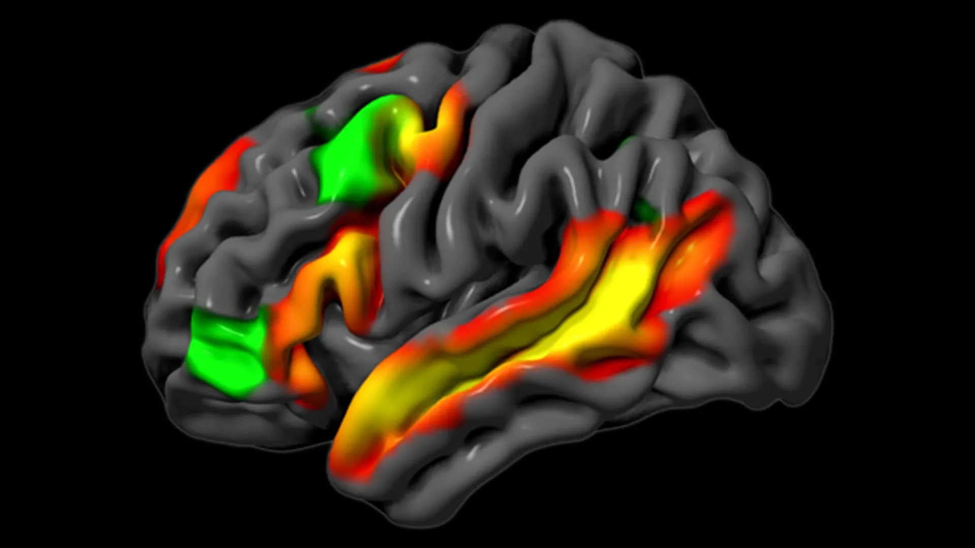MIT: the brain can reason logically without language